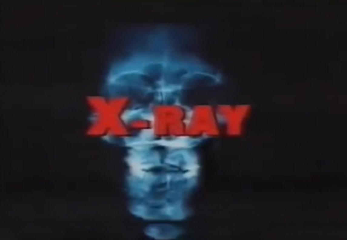 X-Ray (1982)
